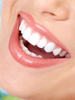 RĂNG ZIRCONIA LÀ GÌ ?